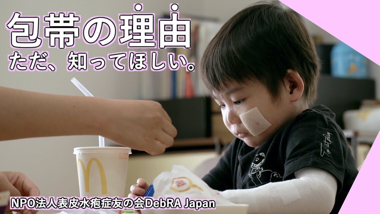 『表皮水疱症と生きる』動画サムネイル